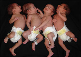 Photo of quadruplets