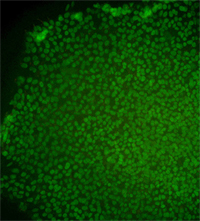 Immunostained image for the CT3 stem cell line 