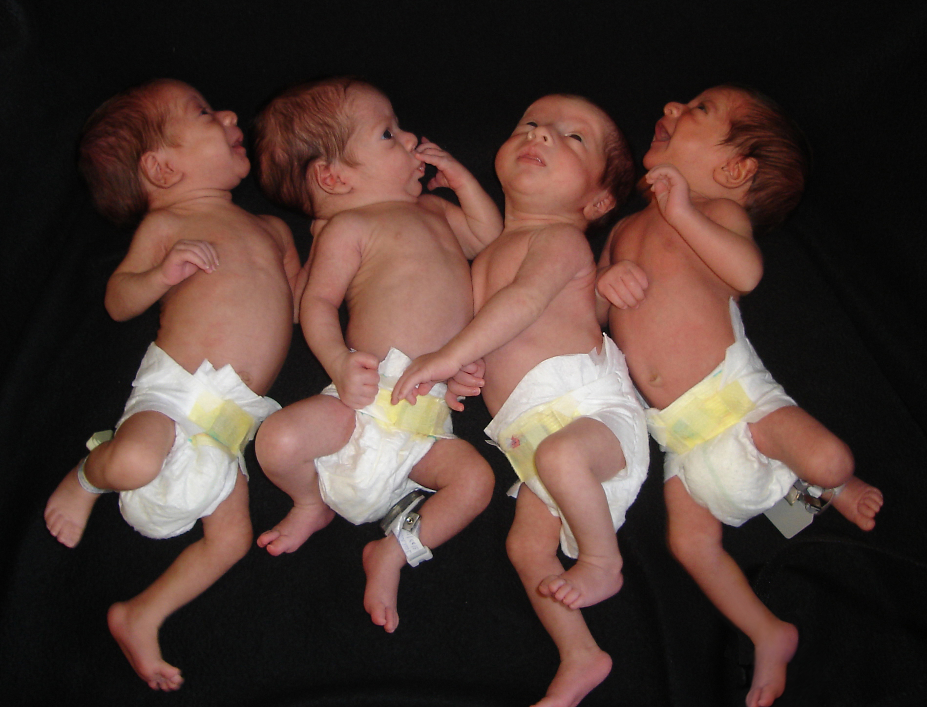 Рождения четверых детей. Четверняшки Смит – 1750 г.. Сиамские четверняшки. Двойняшки тройняшки четверняшки. Близнецы тройняшки.